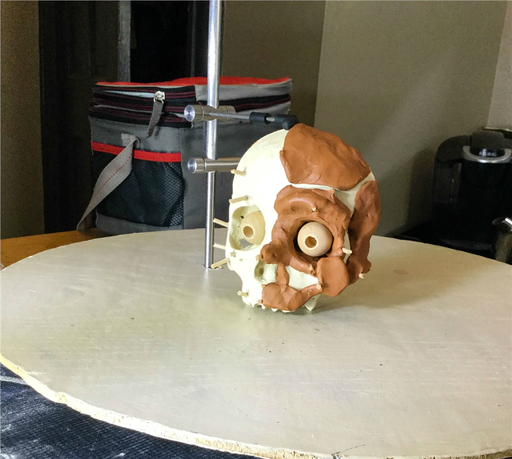 3D列印人類頭骨模型