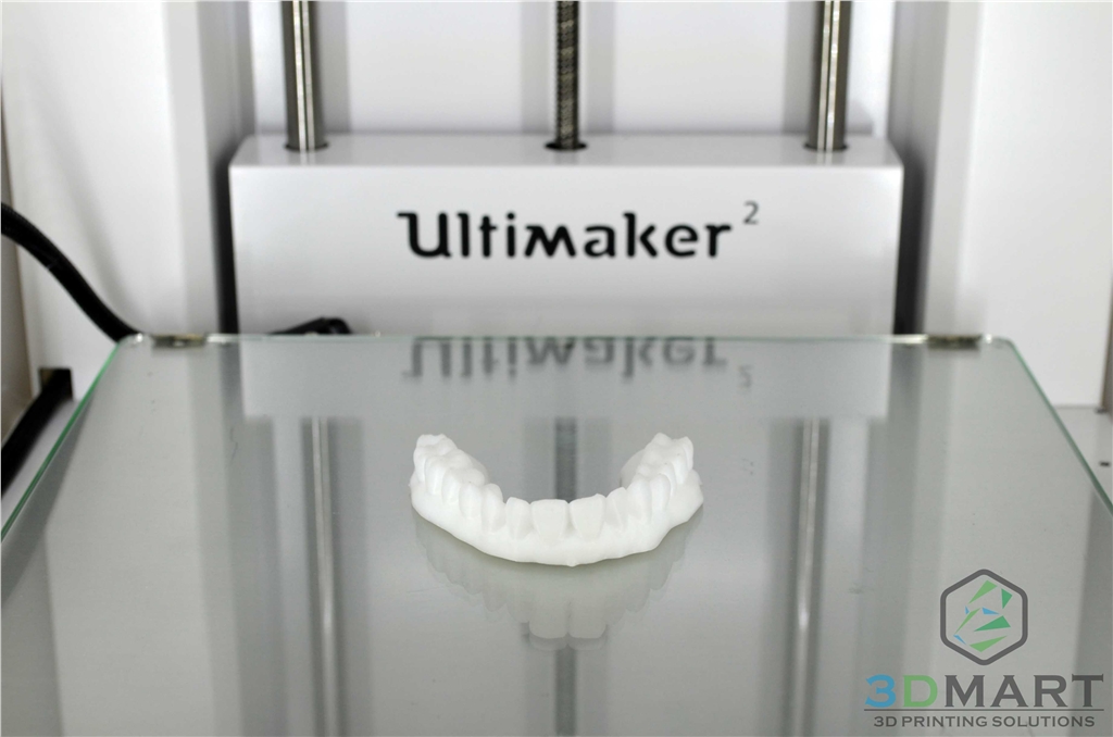 3D列印，牙齒，齒模，HIPS,