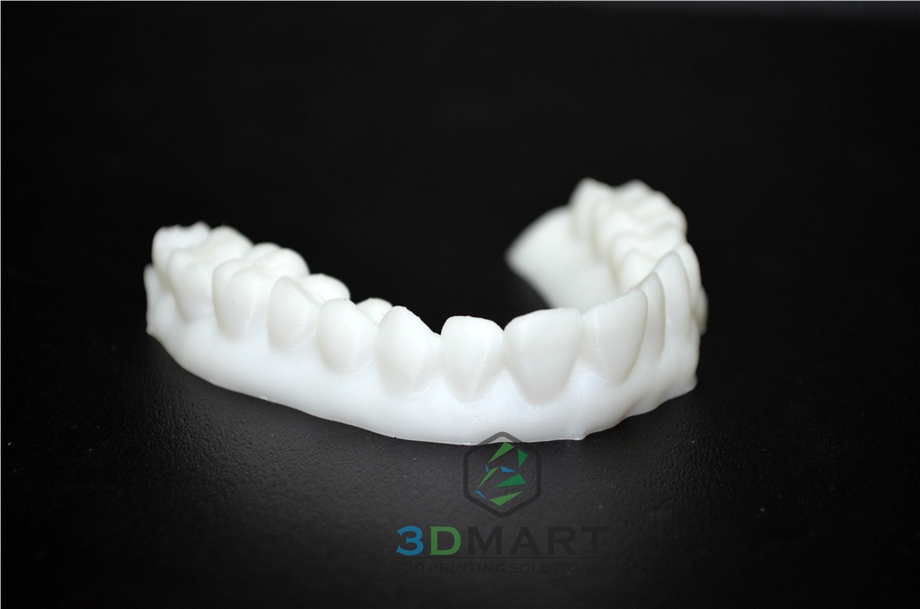 3D列印，牙齒，齒模，HIPS, ULTIMAKER2