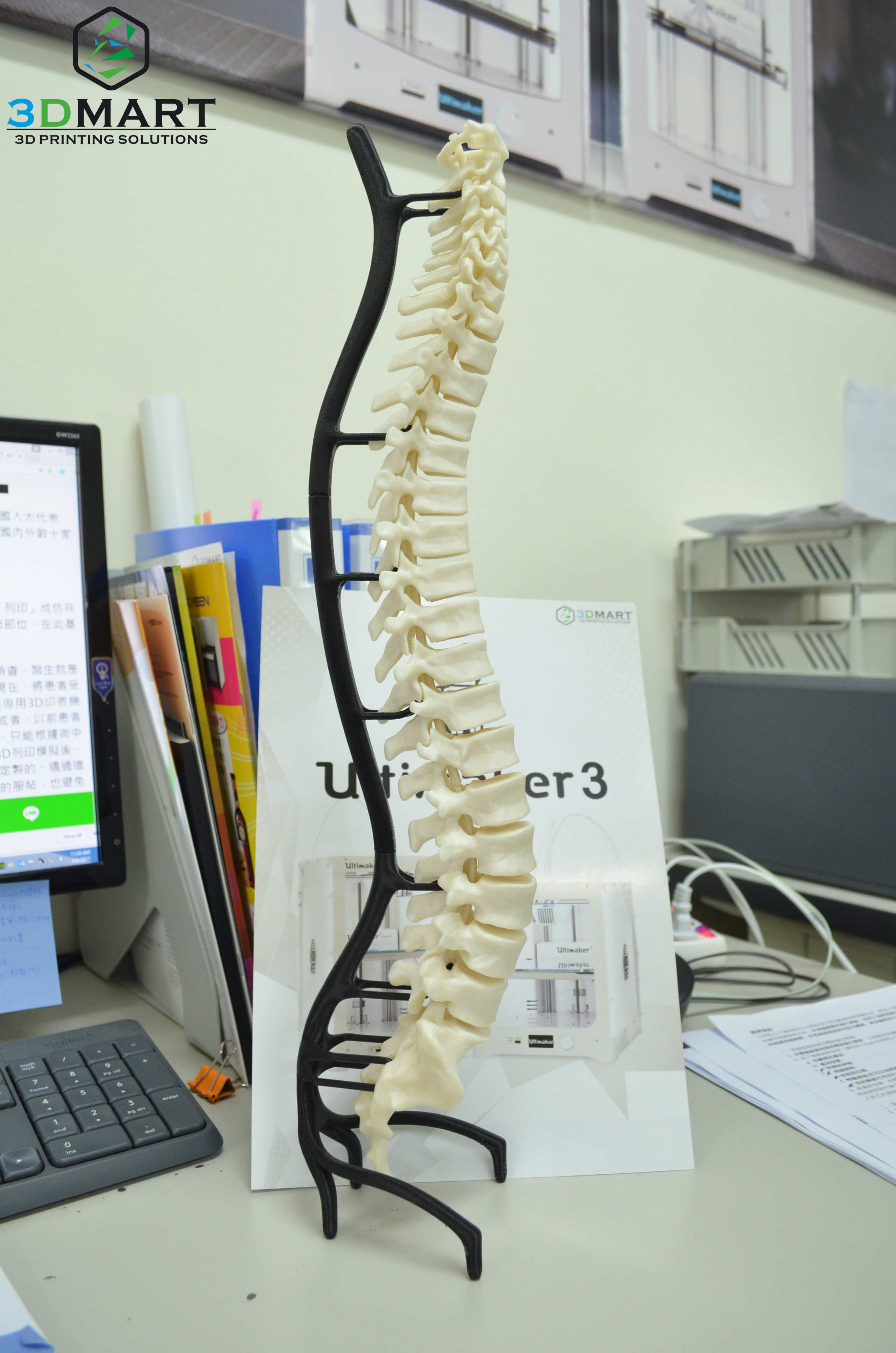 Ultimaker 3D列印機能夠醫(yī)療設(shè)備 Ultimaker 3D列印機能夠醫(yī)療設(shè)備